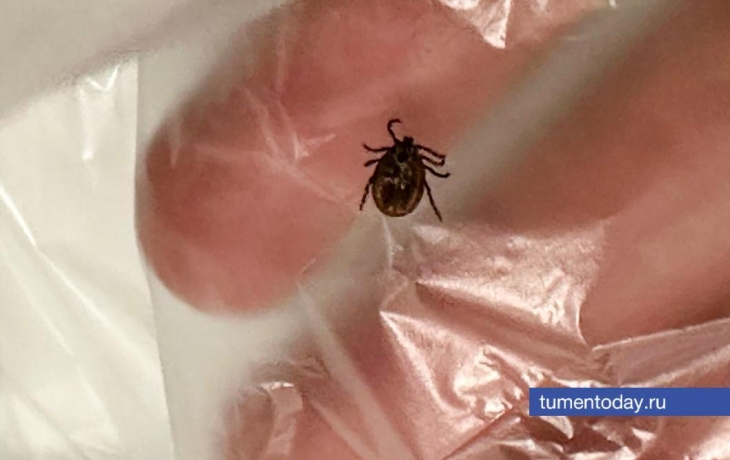 25 случаев клещевого энцефалита выявлено в Тюменской области с начала сезона 25 случаев клещевого энцефалита выявлено в Тюменской области с начала сезона