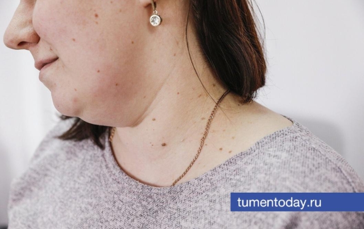 Вирус папилломы человека: что миф, а что правда, разбирается специалист Вирус папилломы человека: что миф, а что правда, разбирается специалист